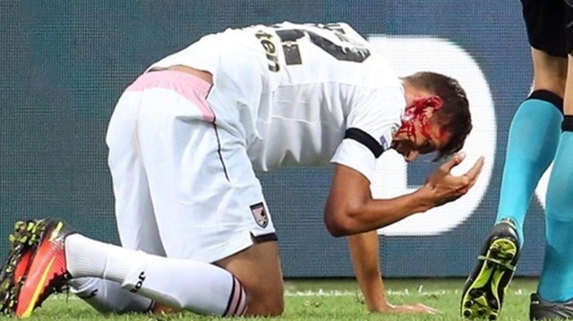 İnter-Palermo karşılaşmasında Palermo forması giyen Norbert Balogh, yüzü kanlar içinde yerde kaldı.