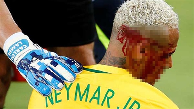 Brezilya'nın yıldızı Neymar, Bolivya maçında talihsiz bir sakatlık yaşadı.