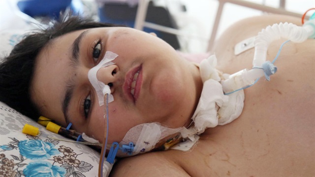 15 yaşındaki Furkan Talha makineye bağlı olarak nefes alabiliyor.