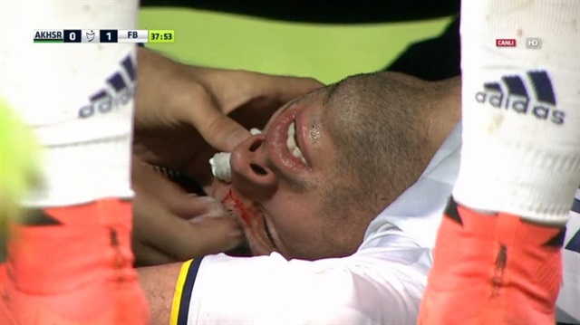 Fenerbahçe'nin Hollandalı golcüsü Van Persie gözüne aldığı darbe sonrası kanlar içinde yerde kaldı. 