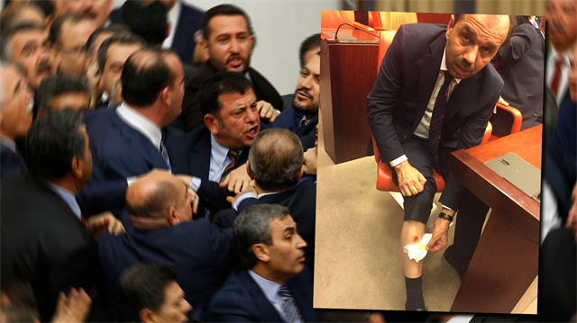Dün TBMM'de çıkan kavgada AK  Parti Trabzon Milletvekili Muhammed Balta ayağından ısırıldı. 