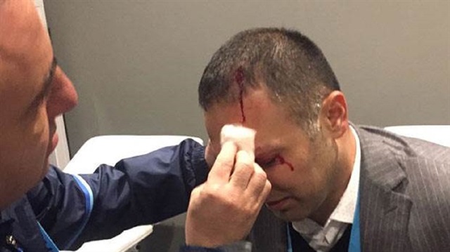 Hasan Çetinkaya maç sonrasında başına gelen cisimle yaralandı. 