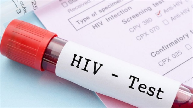 Sağlık görevlisinin ihmali yüzünden 5 hastaya AIDS bulaştı