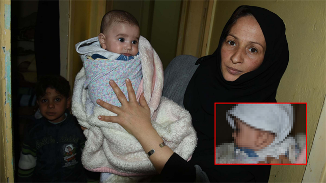 İzmir'de yaşayan Suriyeli bebeği ve annesini fareler kemirdi