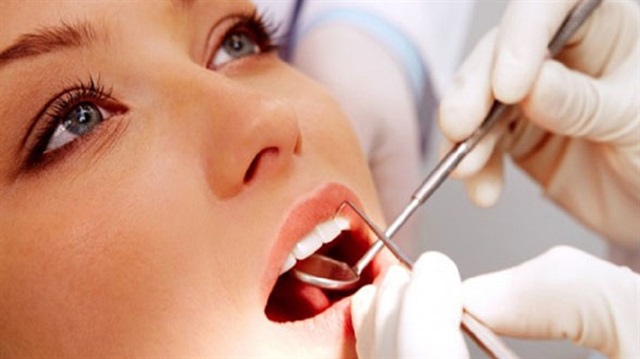 Uzmanlar bakımsız dişlerin kalp krizinden felce kadar çeşitli hastalıkları tetiklediğini bildirdi.