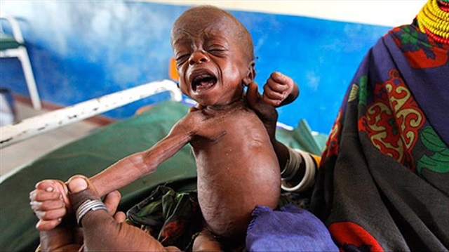Afrika'nın 4 ülkesinde 20 milyon kişi, açlık tehdidiyle karşı karşıya...