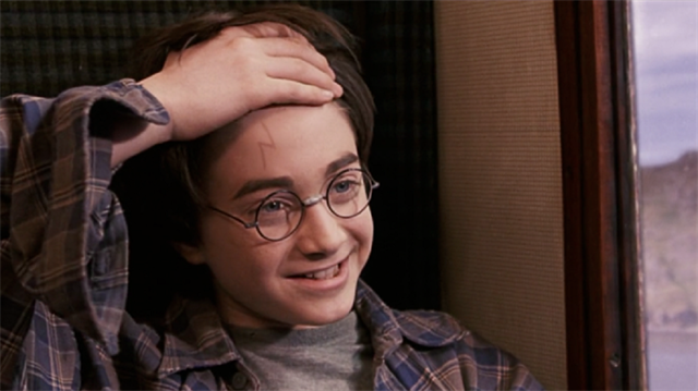 Datome, kafasına aldığı yarayla sosyal medyada Harry Poter karakterine benzetildi.