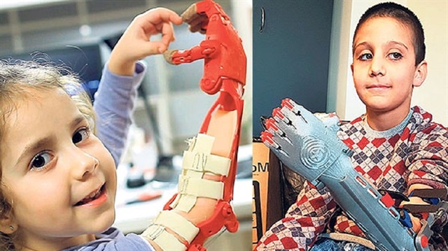 Çocuklar robotik elleriyle kendilerini daha iyi hissediyor.