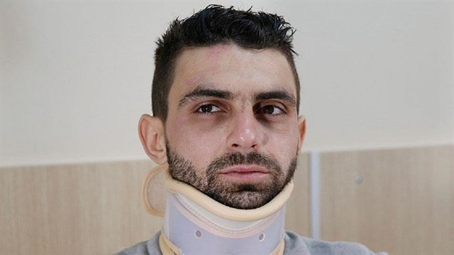 Turkish protester Huseyin Kurt was diagnosed with cervical vertebra and lumbar fractures.