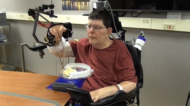 56 yaşındaki Bill Kochevar, robotik kolun uygulandığı ilk kişi.