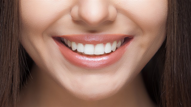 Bonding uygulaması; diş hekiminin hastaya 1-2 seansta uyguladığı ve dişlerin aralıklarının kapatılmasında, diş kırıklarının kapatılmasında, ufak tefek çapraşıklıkların düzeltilmesinde, bazı dişlerin uzatılmasında yada dışarıya doğru çıkartılmasında kullanılan özel bir tekniktir