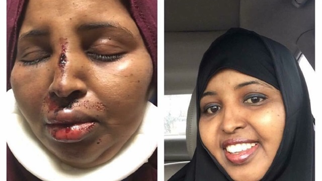 ​ABD'de Müslüman kadına igrenç saldırı ​