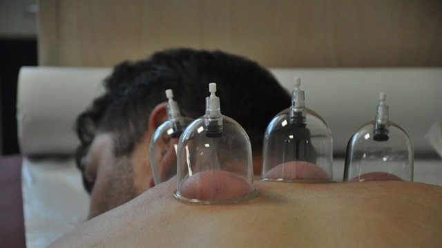 Devletten hacamat ve akupunktur polikliniği müjdesi!