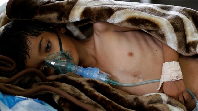 Yemen'deki kolera salgını yayılıyor
