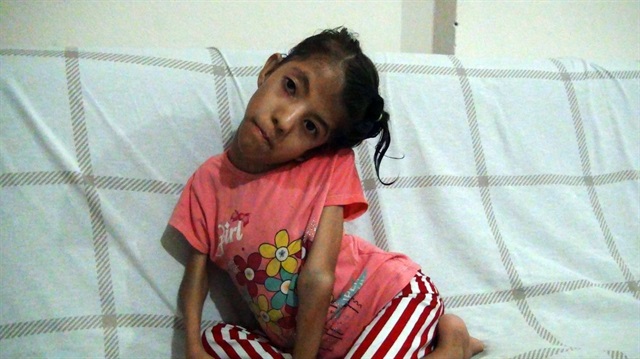 Doğuştan skolyoz hastası olan küçük Elif Nur, ameliyat olmak ve kardeşleri gibi yürümek, okuluna rahat rahat gitmek istiyor.