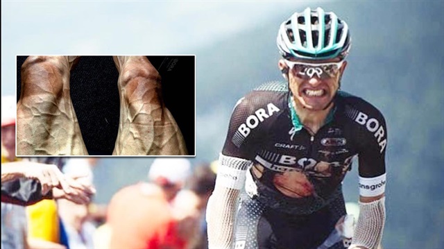 Fransa Bisiklet Turu'nda 16. etabın sonunda bacaklarının fotoğrafını paylaşan bisikletçi Pawel Poljanski, gecenin en çok konuşulan isimlerinden oldu. 