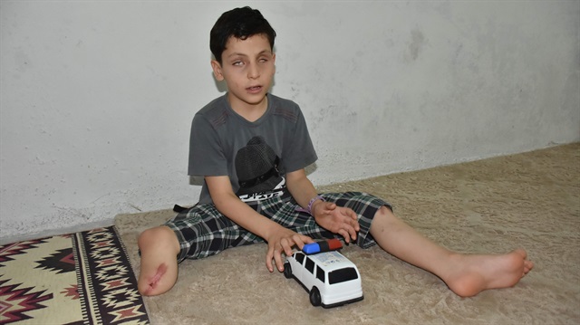 طفل سوري فقد ساقه وعينيه جراء قنبلة "داعش" يأمل الحصول على طرف صناعي