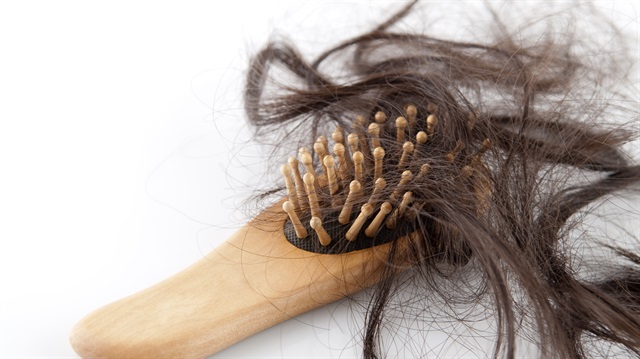 Kadınlarda saç dökülmesi durdurulabilir