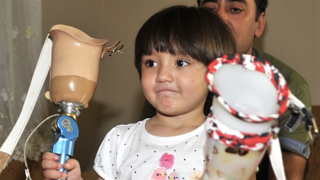 Baba Ali İhsan Yıldırım, yaptığı açıklamada, İstanbul'da takılan protezin daha güzel olduğunu, kızını bu proteze istenildiği gibi alıştırmaya çalışacağını söyledi. 
