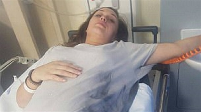 ​İngiltere’de yaşayan Kathleen Walsh (25) adlı hamile kadının, uyurken akıllı cep telefonunun patlaması sonucu eli yandı.


