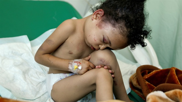 Yemen'in başkenti Sana'da Suudi Arabistan öncülüğündeki hava saldırılarında tüm ailesini kaybeden küçük bir kız çocuğu... 