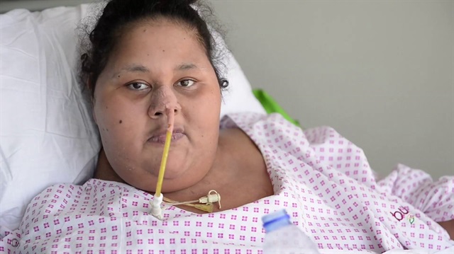 ​Birleşik Arap Emirlikleri'nde yaşayan ve 440 kilo olan Mısırlı genç kadın, hayatını kaybetti.