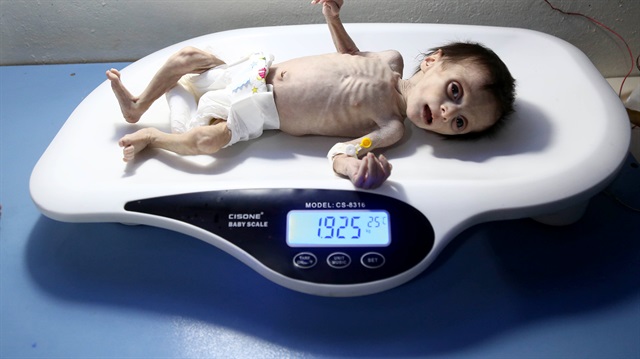 Gıdasızlıktan ölen Suriyeli bebeğin son anları kameraya yansıdı  