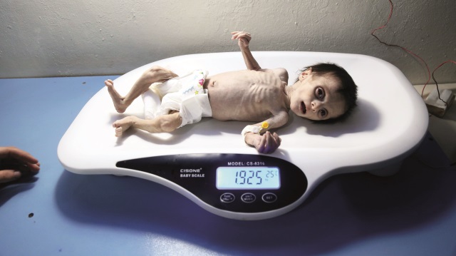Bu bebek açlıktan hayatını kaybetti