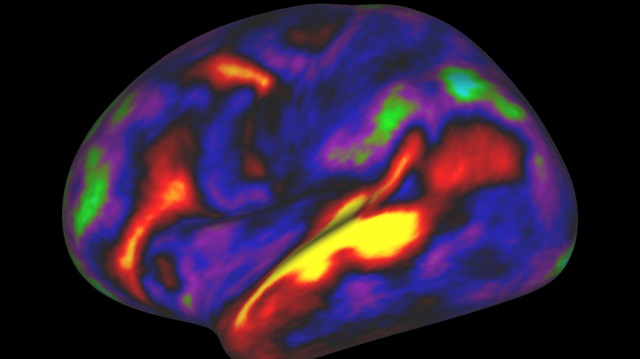 A scan of a brain used in a study 