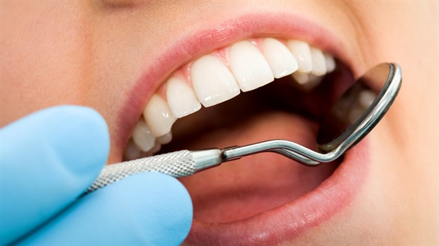 Diyabet, diş eti hastalığına yakalanma riskini arttırıyor. 