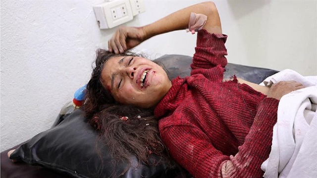 Doğu Guta'da yaralanan Suriyeli küçük kız çocuğu