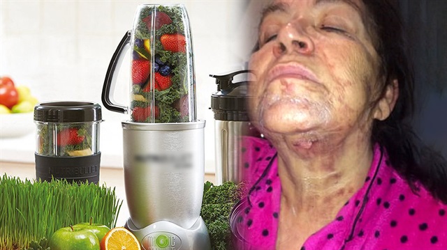  "Katil blender" olarak adlandırılan mutfak aleti nedeniyle birçok kadın zarar gördü. Parmağını kaybeden bir mağdur ise sağlığını geri kazanmak için 400 bin dolar harcadı.