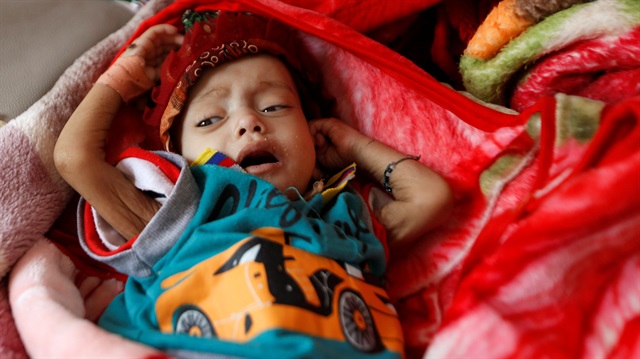 Yemen'de insanlık dramı: 10 dakikada bir çocuk yaşamını yitiriyor