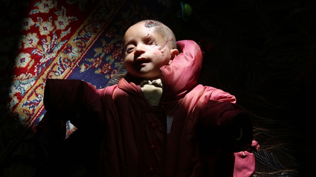 Suriye'de Beşşar Esed rejiminin abluka altındaki Doğu Guta'nın Hammuriye beldesine düzenlediği topçu saldırısında annesiz kalan ve sol gözünü kaybeden Kerim bebek, yaşama tutunmaya çalışıyor. 