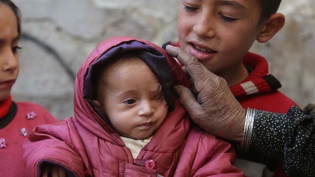 A miraculous struggle for life of a Syrian baby in Eastern Ghouta