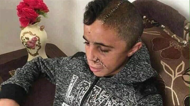 Fourteen-year-old Mohammed Tamimi