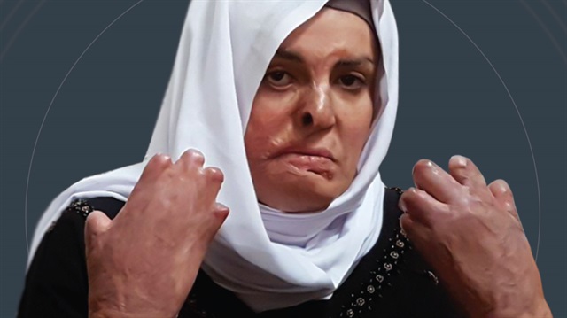 İşgal altındaki Doğu Kudüs'te iki yıl önce otomobilindeki tüpün patlaması sonucu vücudunun yüzde 60'ı yanan İsra Ceabis'in tıbbi ihtiyaçları karşılanmıyor. (Fotoğraf: AA)