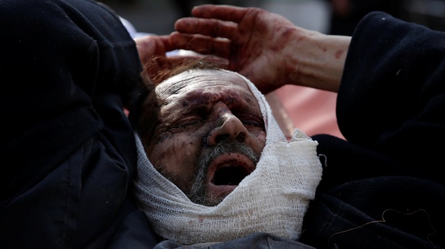 Afganistan'ın başkenti Kabil'de düzenlenen intihar saldırısında yaralanan bir kişi... (Fotoğraf: Reuters)