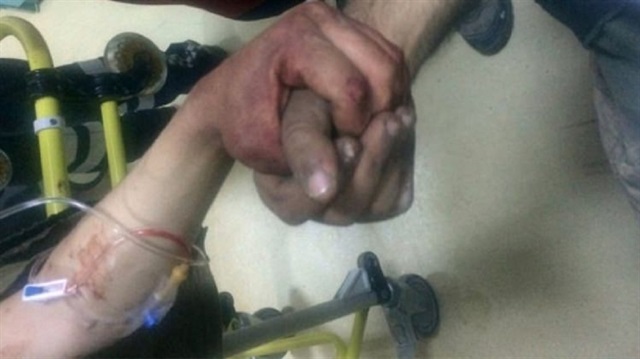 Afrin'de yaralanan askerlerimiz hastanede birbirlerinin ellerini hiç bırakmadı.