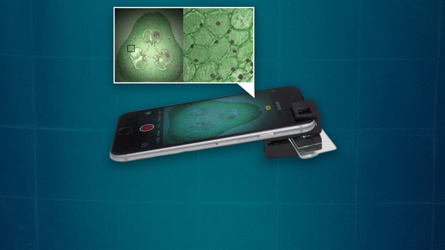 Bilim insanları mobil cihazları her alanda kullanılmak üzere gelişmiş bir mikroskoba çevirecek aparat üretti.