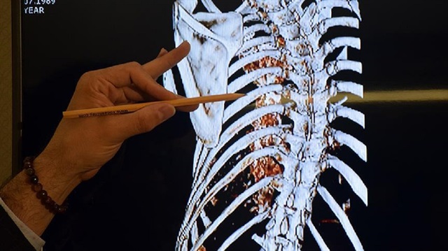 Sinir dokuların problemleri ile alakalı hemen hemen her alanda, hücrelerin canlılığını sağlaması ve onun yaşayabilirliğini korumasında kullanılabilecek.