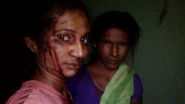 Rupali Meshram (solda) saldırının hemen ardından annesiyle selfie çekti.