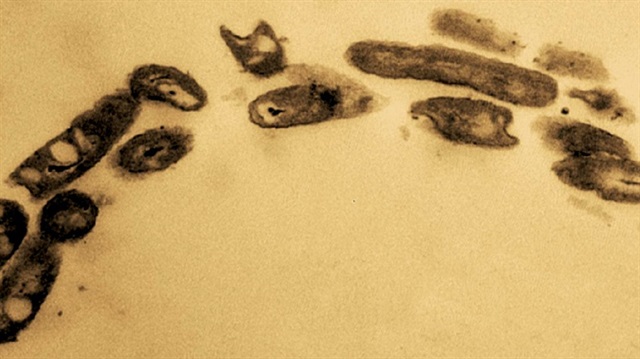 Alcanivorax borkumensis bakterisinin mikroskobik görüntüsü.