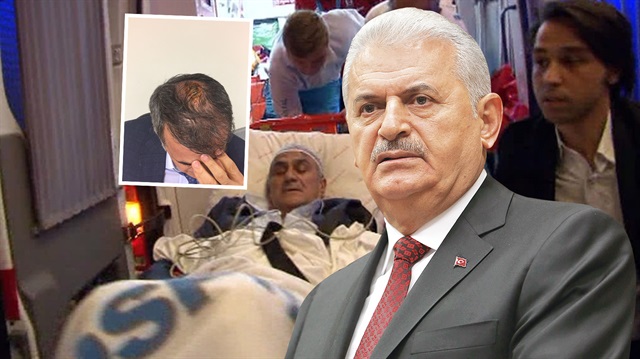 Başbakan Yıldırım dün oynanan derbide yaralanan Şenol Güneş'e geçmiş olsun mesajı yolladı.