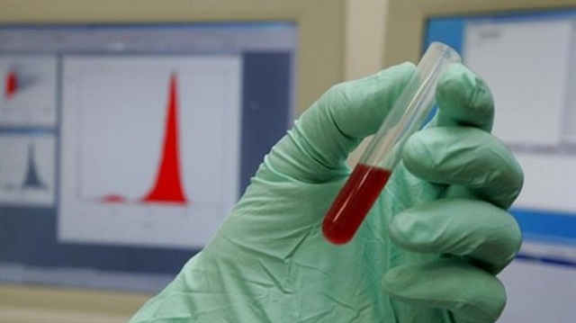 بقطرة دم.. اختبار جديد يكشف مبكراً الإصابة بسرطان البنكرياس