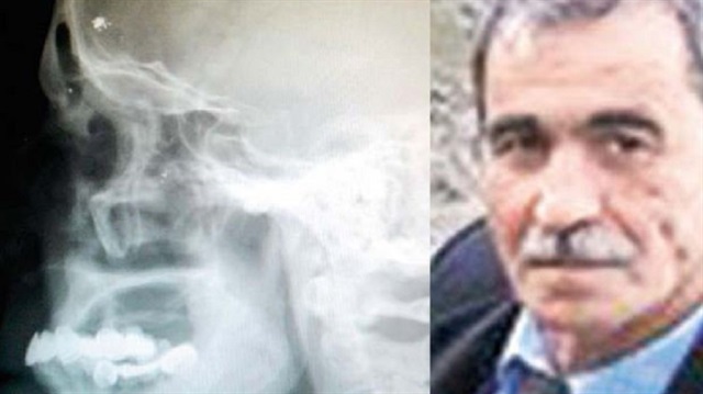Mustafa Tiryaki, 29 Temmuz 1978’de Şanlıurfa Jandarma Hudut Taburu’nda vatani görevini yaparken  kaçakçılarla girdiği çatışmada  yaralandı. 