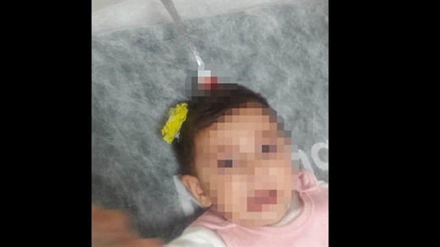 5 yaşındaki ablasının kardeşine fırlattığı çatal, küçük bebeğin kafasına saplandı. 