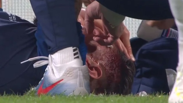 Olivier Giroud, çarpıştığı oyuncuyla birlikte kanlar içerisinde yerde kaldı.
