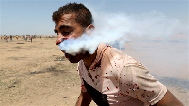 Heysem Ebu Seble isimli Filistinli, İsrail askerlerinin attığı gaz bombasının ağzına isabet etmesi sonucu ağır yaralanmıştı. (8 Haziran 2018-Fotoğraf: Reuters)