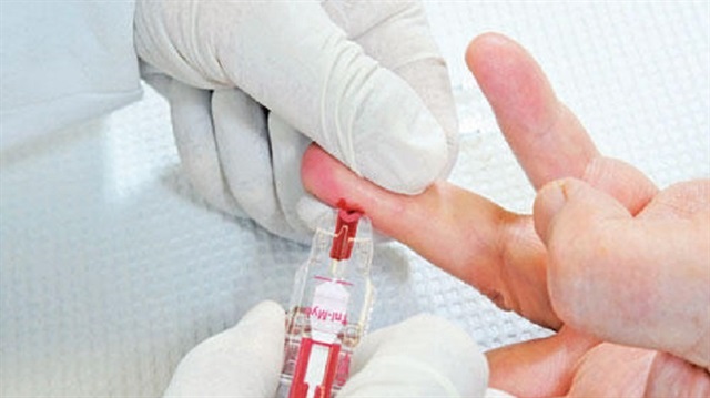 اختبار دم يتنبأ بخطر إصابة المواليد بالشلل الدماغي التشنجي